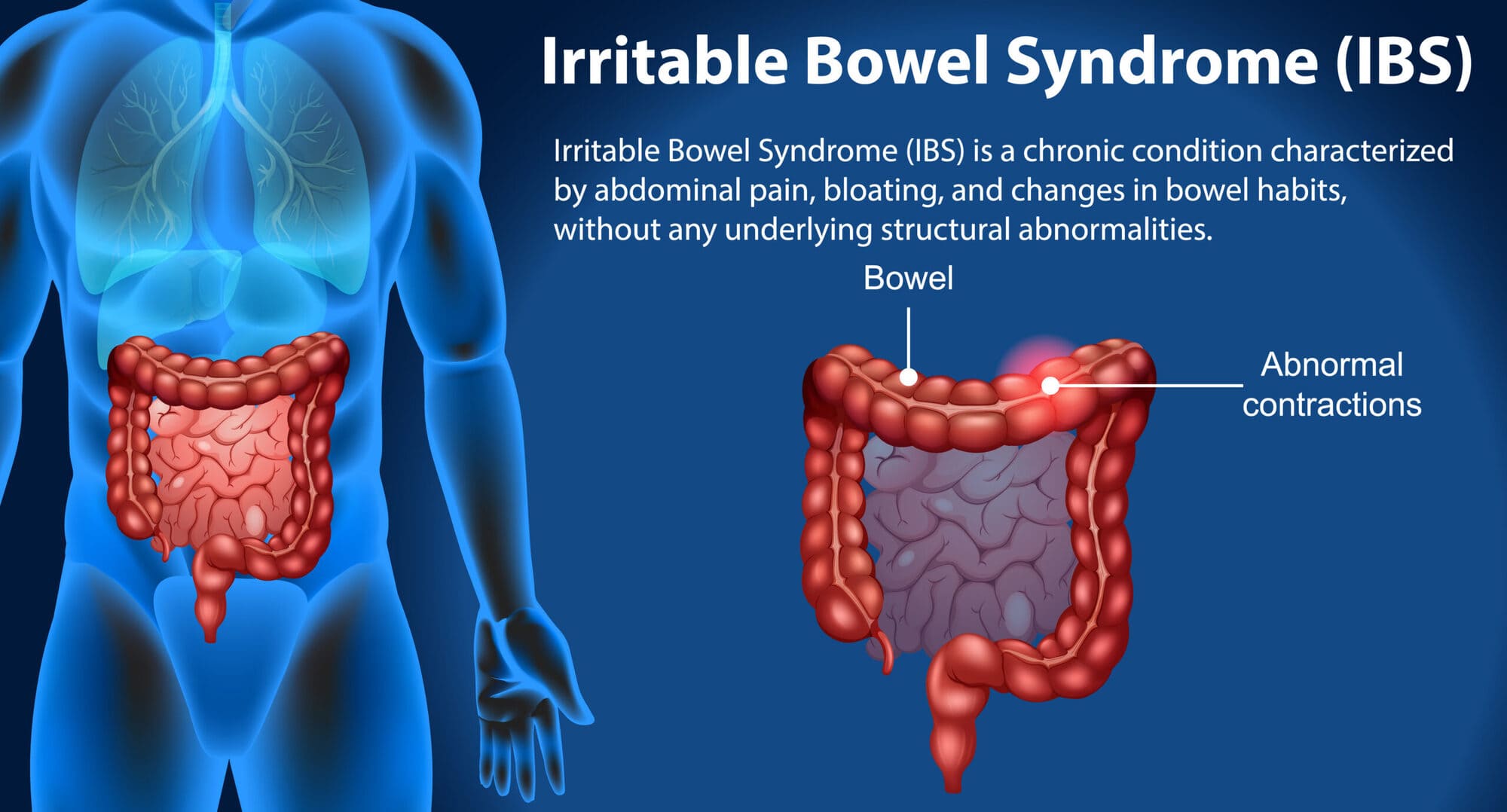 navigating the complex world of irritable bowel syndrome ibs